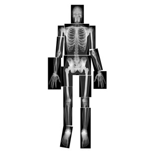 ROYLCO INC True to Life Human X-rays Educational Tool