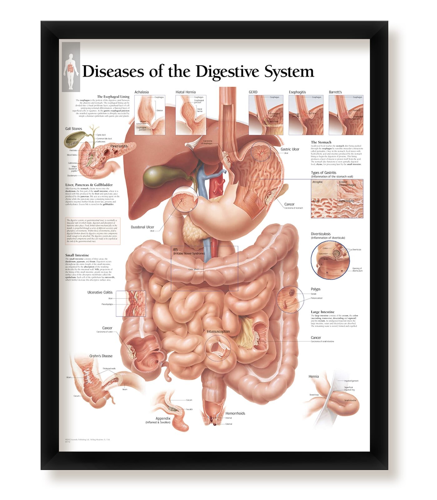 Wall Decor Laminated Poster The Digestive System Educational Art for Offices 