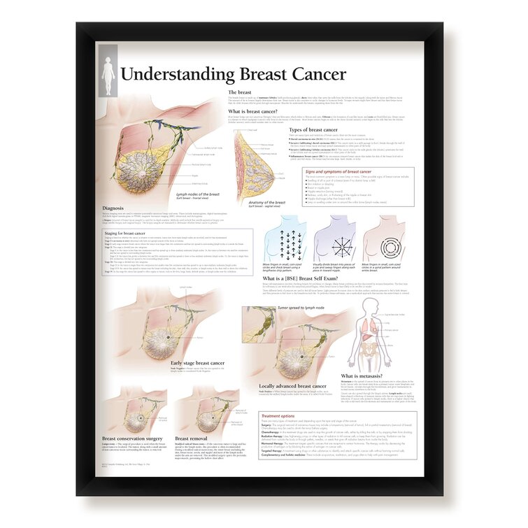 WallsThatSpeak Understanding Breast Cancer Framed Medical Educational  Informational Poster Diagram Doctors Office School Classroom 22X28 Inches |  Wayfair